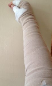 Compression Bandaging